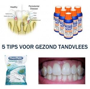 gezond tandvlees