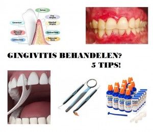 gingivitis