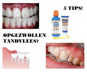 opgezwollen tandvlees