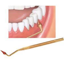 parodontitis behandeling
