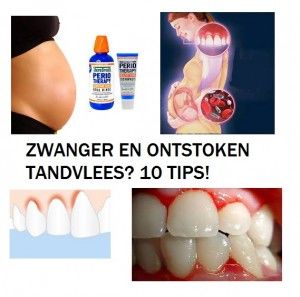 zwanger ontstoken tandvlees