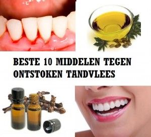 Laboratorium ruw patroon Beste 10 middelen tegen Ontstoken Tandvlees – Ontstoken Tandvlees? | Top10  Tips – Beste Middelen