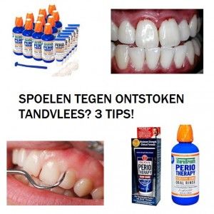 Goot kaart vermoeidheid Ontstoken tandvlees SPOELEN? | 10 Tips – Let op! – Ontstoken Tandvlees? |  Top10 Tips – Beste Middelen